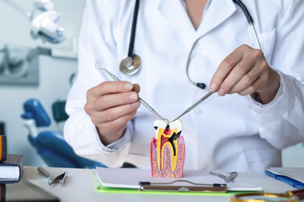 Root Canal Therapy in Cypress TX