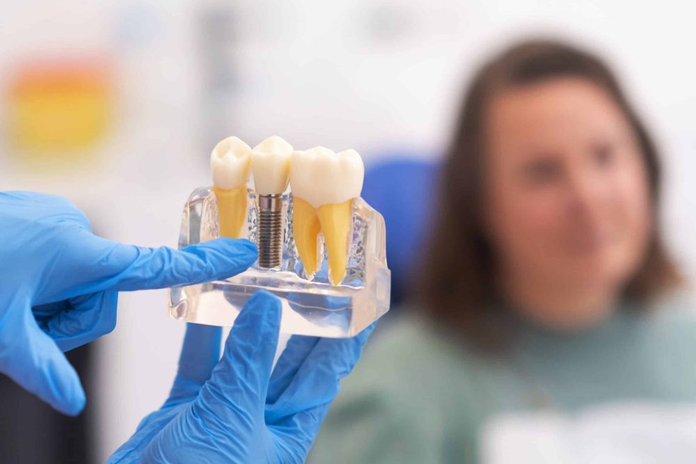 Dental Implants Cypress